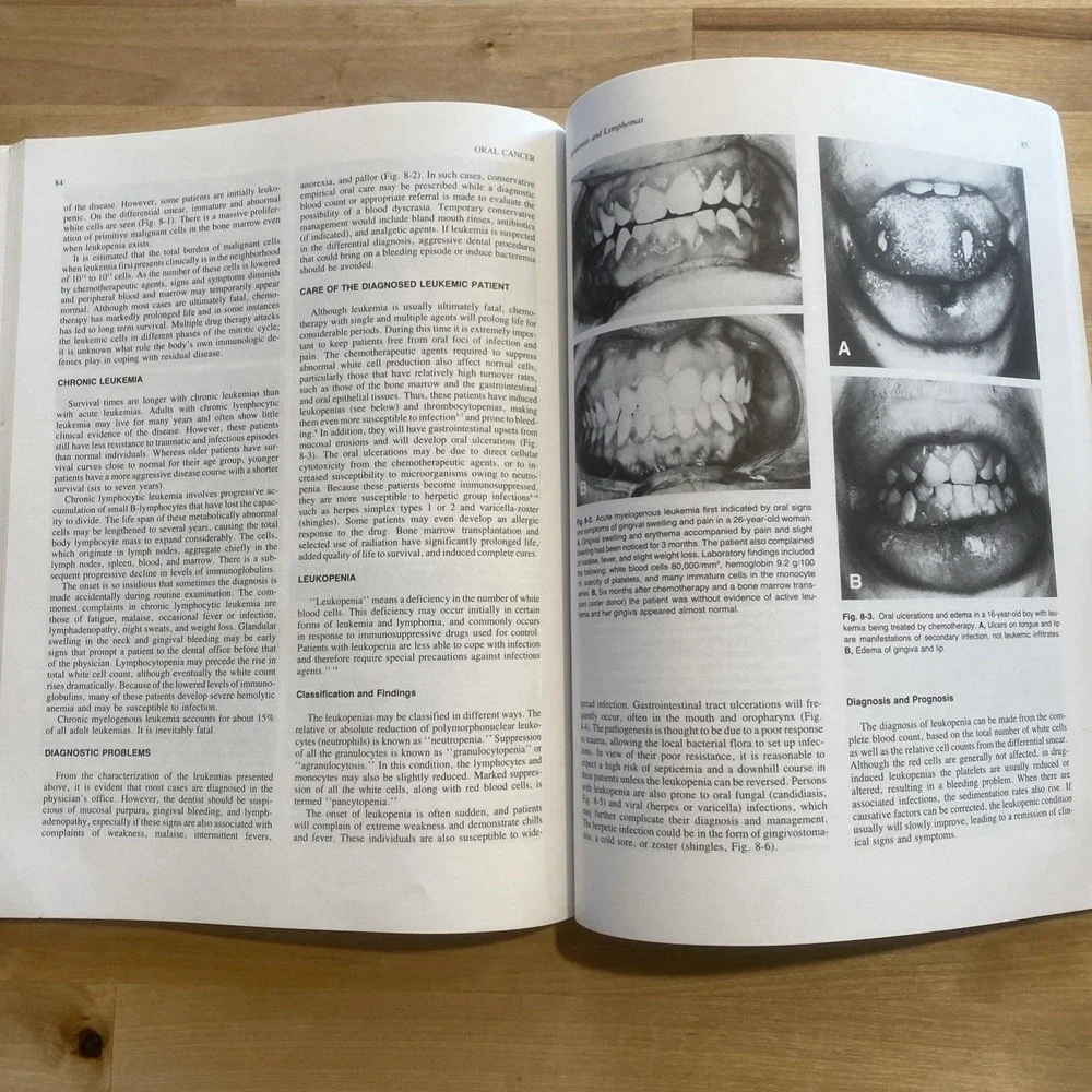 Oral‎ Cancer by Sol Silverman Jr 1985 American Cancer Society Second Edition
